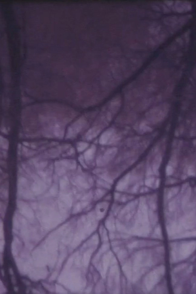 The Burning Tree