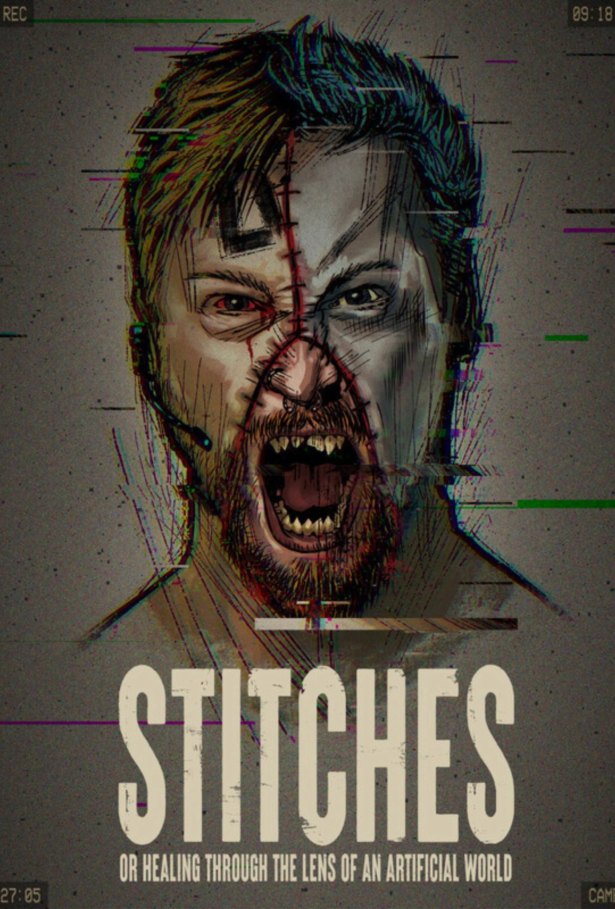Stitches