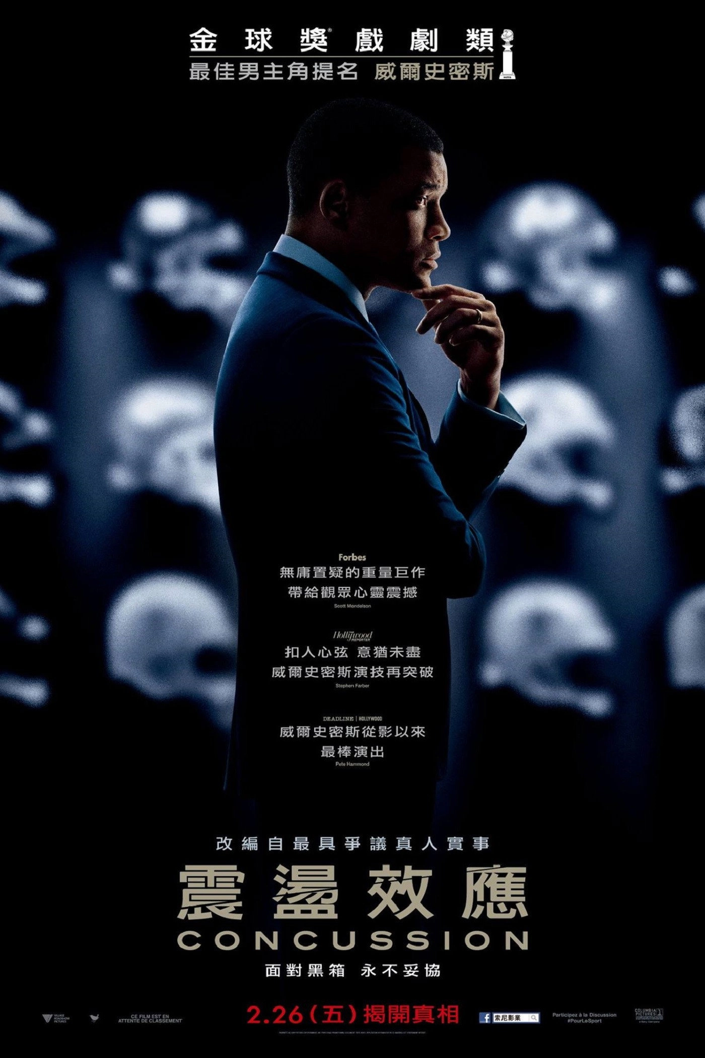 Concussion