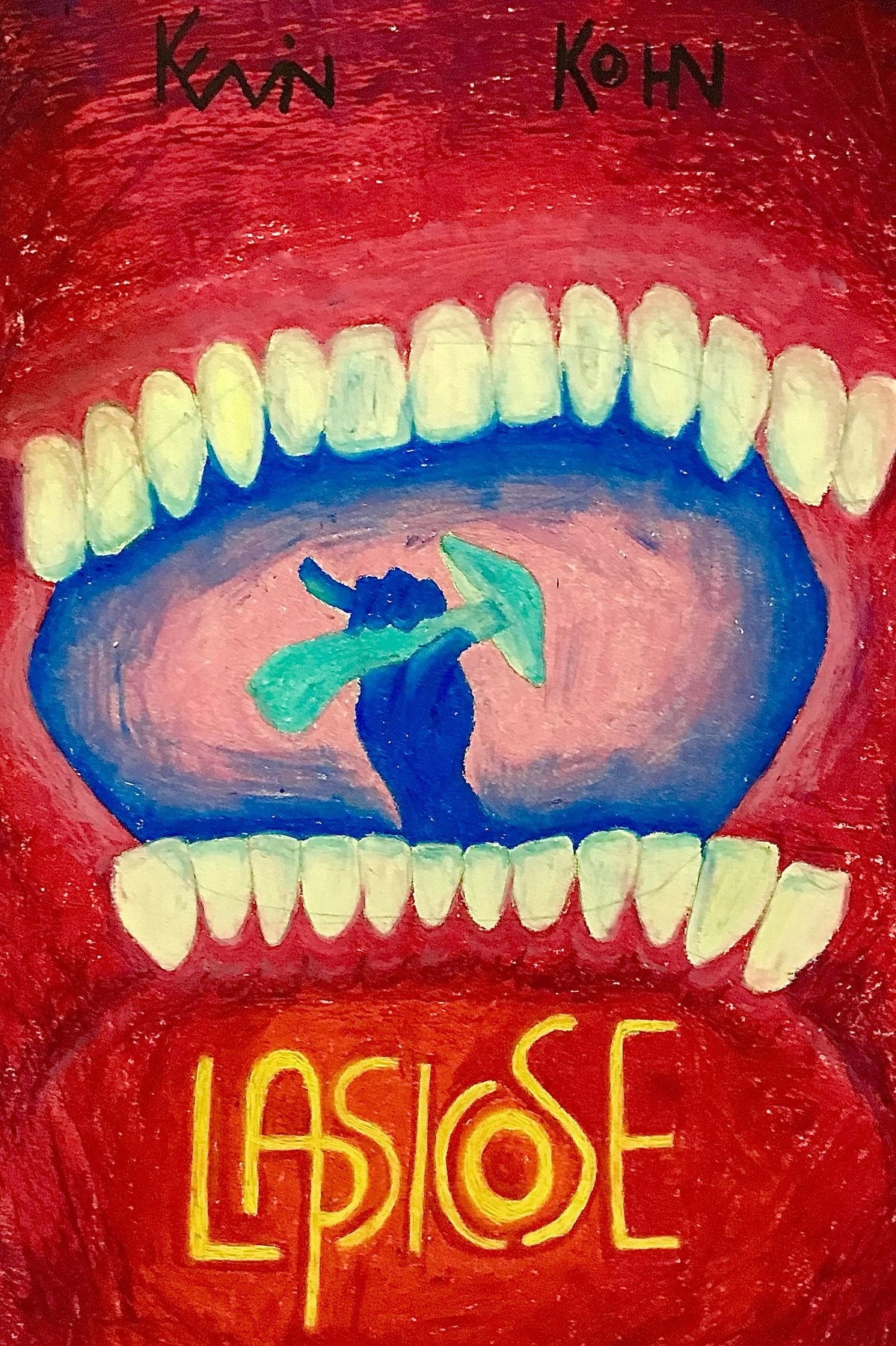 Lapsicose