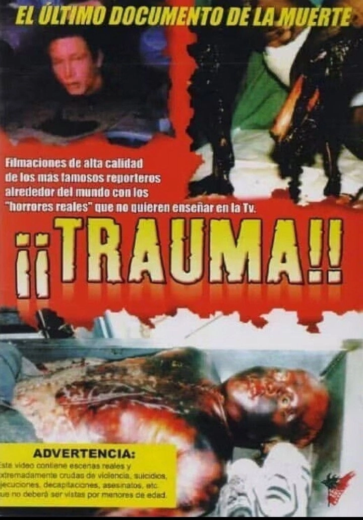 Trauma