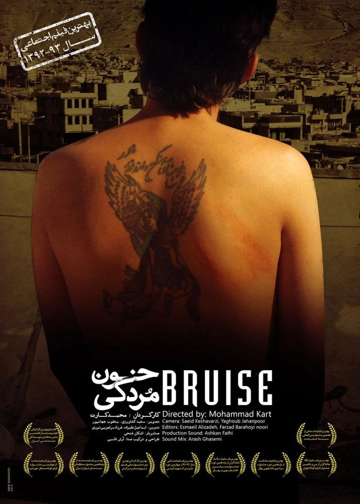 Bruise
