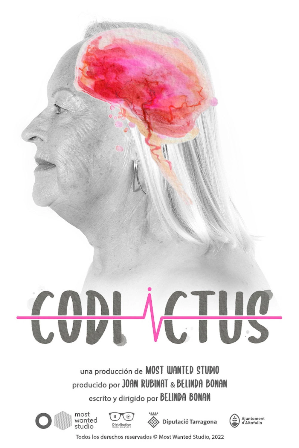 Code Stroke