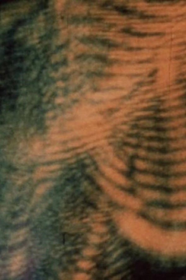 Laserimage
