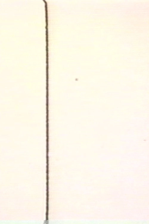 MA (Intervals)
