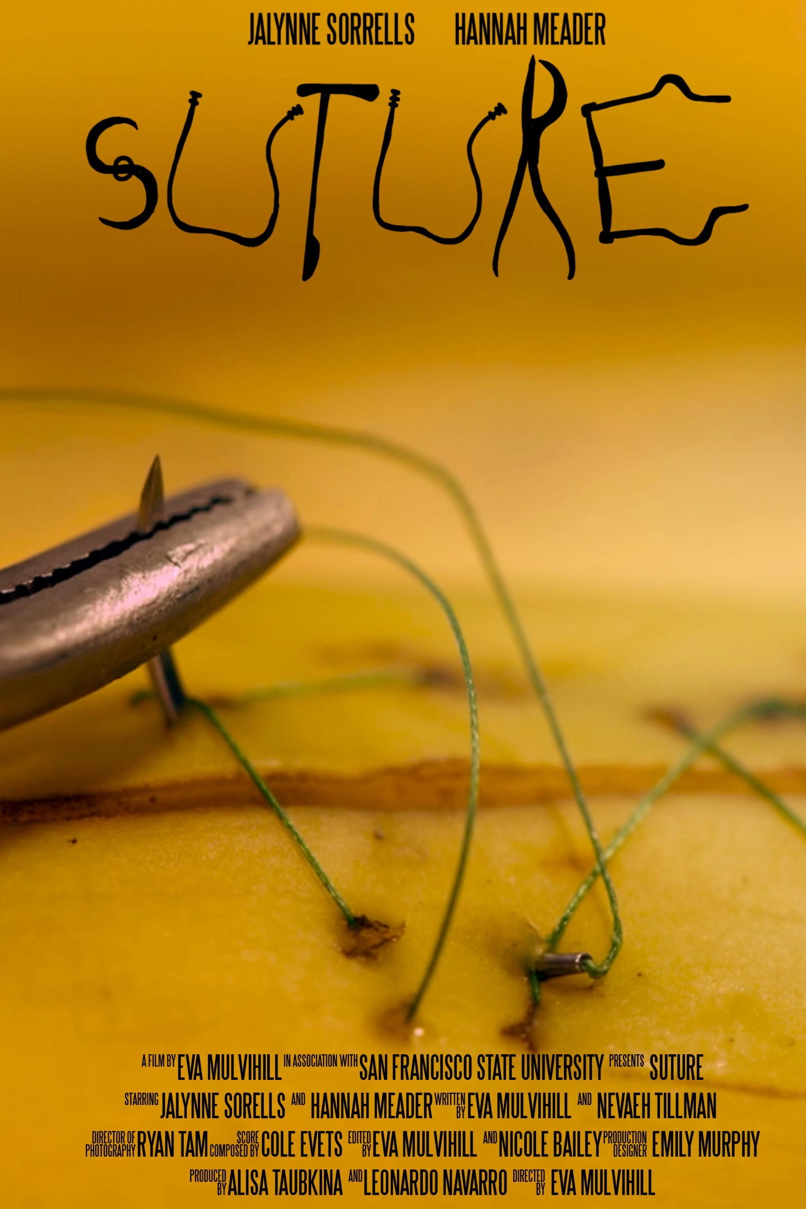 Suture