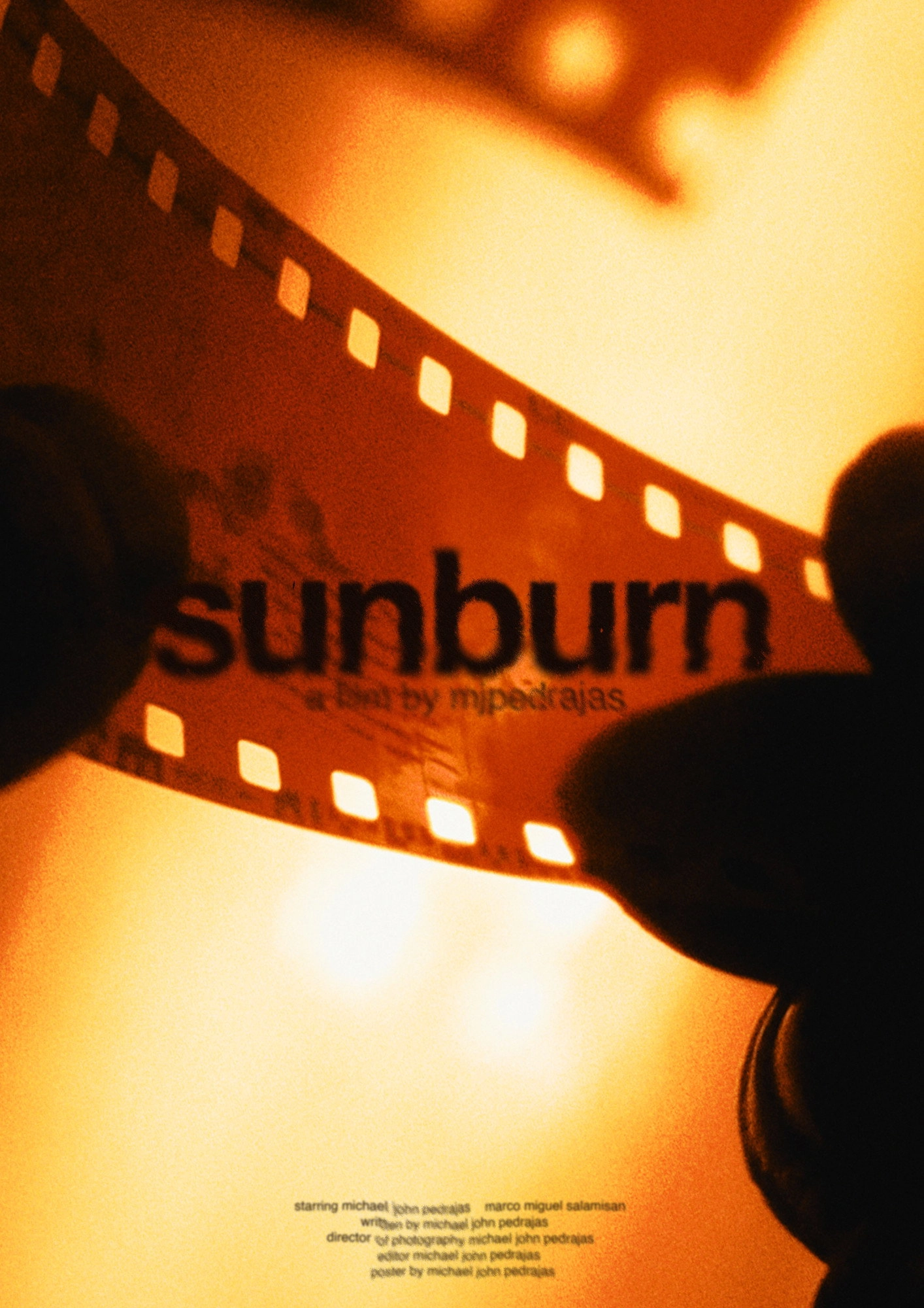 sunburn
