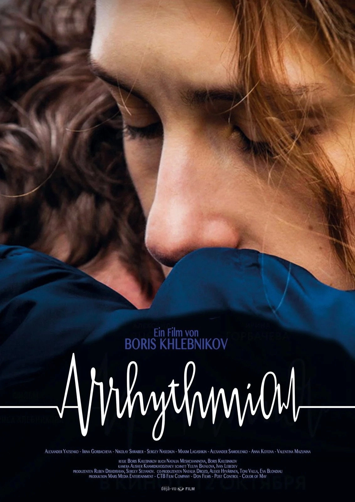 Arrhythmia