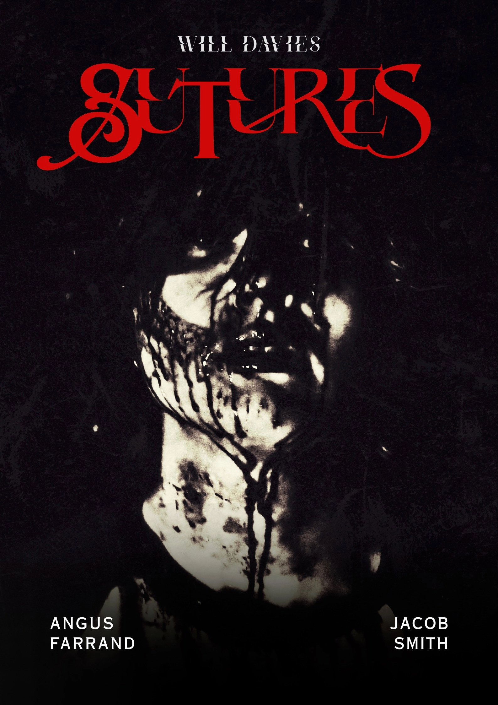 Sutures