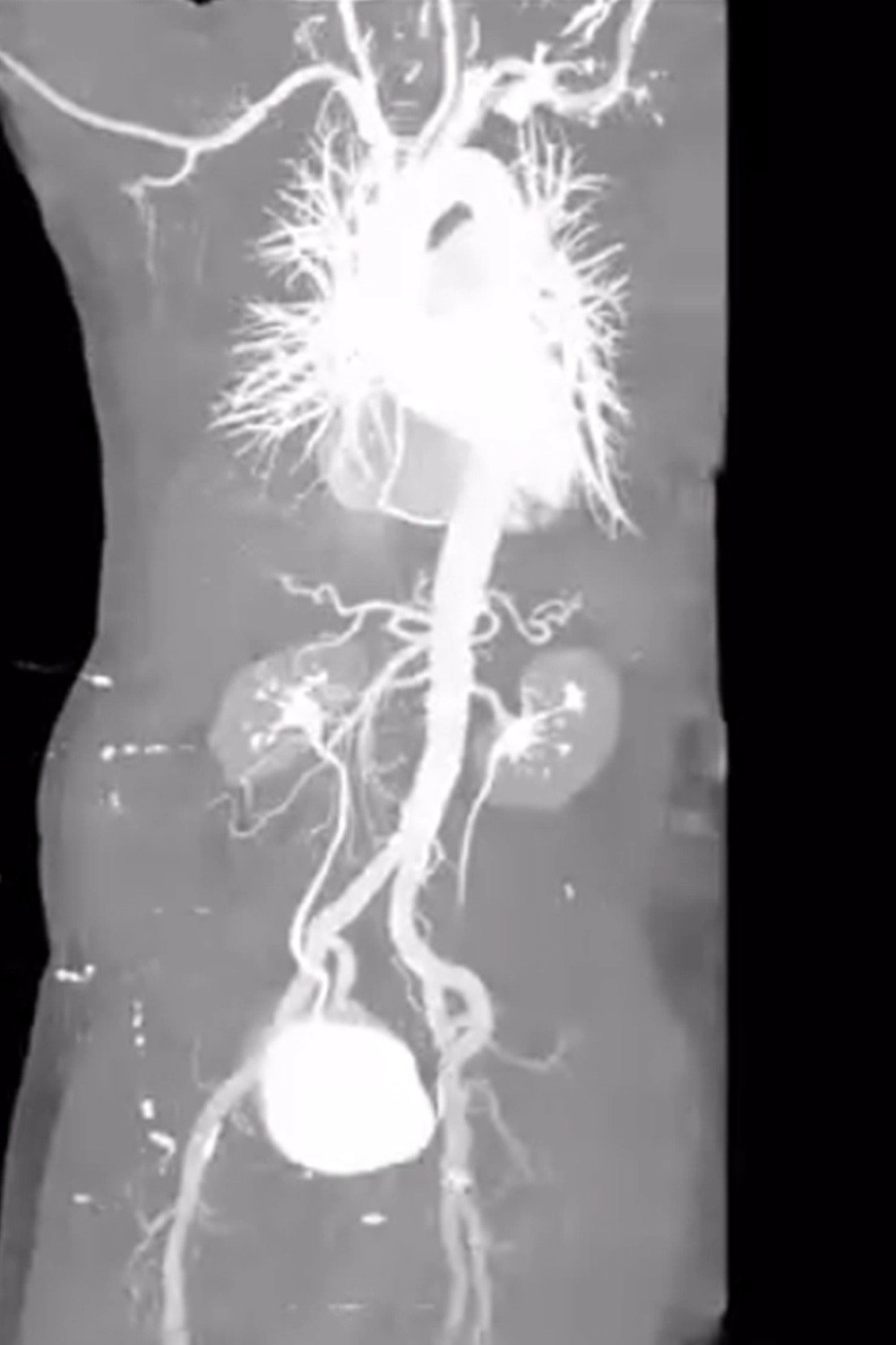 X-Ray Eros
