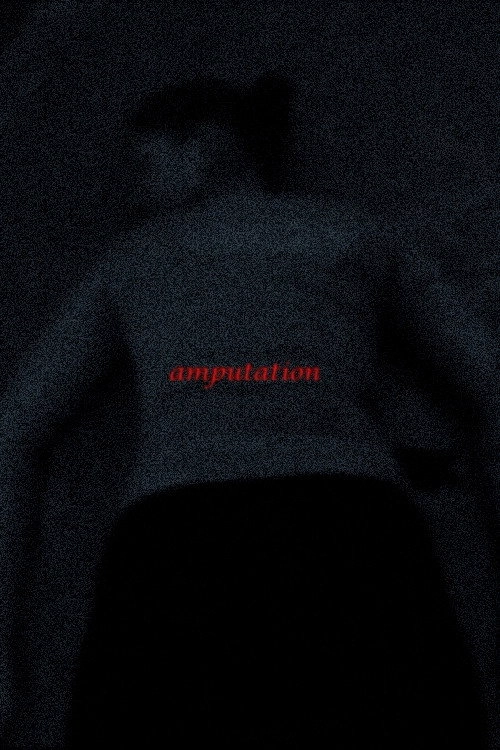 Amputation