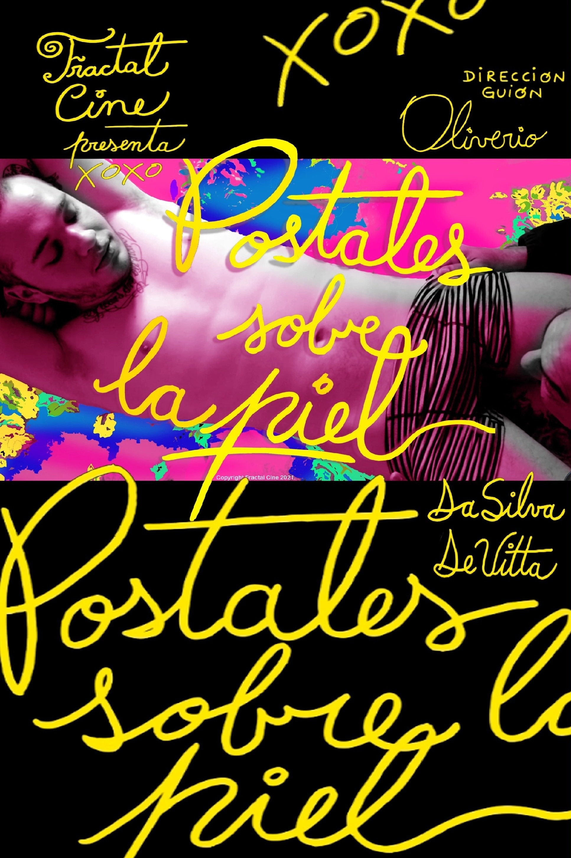 Postcards Over the Skin