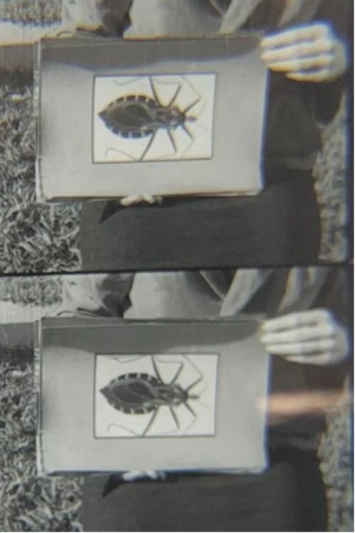 Doença de Chagas