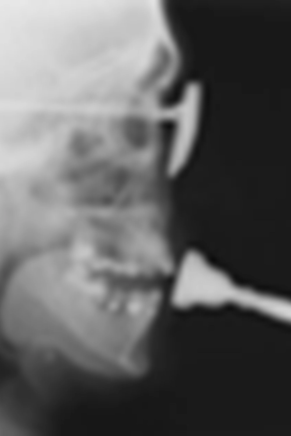Studies in Diagnostic Cinefluorography