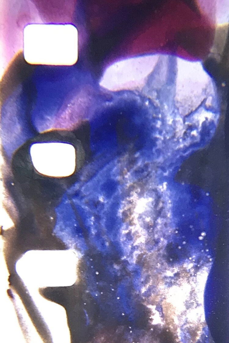 MEDULLACHROME TEST