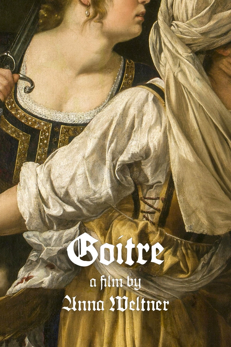 Goitre